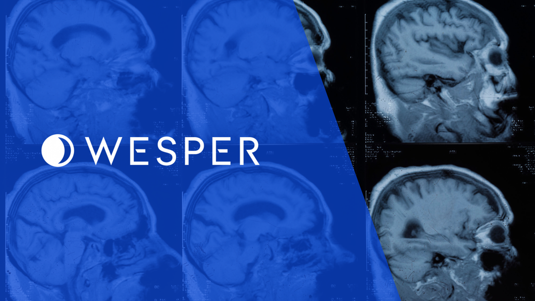 Beyond AHI: What New Research Says About Sleep Apnea and Brain Health