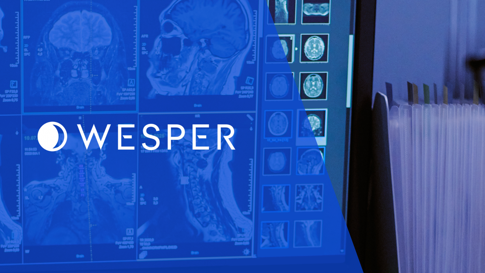 New Research Reveals Sleep Loss Doesn't Just Make You Tired — It Rewires Your Brain