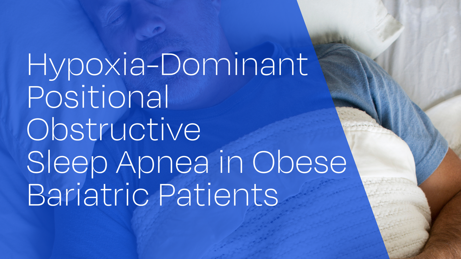Hypoxia-Dominant Positional Obstructive Sleep Apnea in Obese Bariatric Patients: A Distinct and Underrecognized Phenotype
