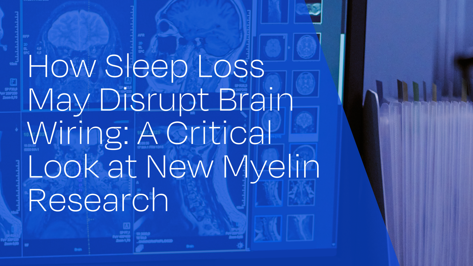 How Sleep Loss May Disrupt Brain Wiring: A Critical Look at New Myelin Research and What It Could Mean for Sleep Apnea Sufferers