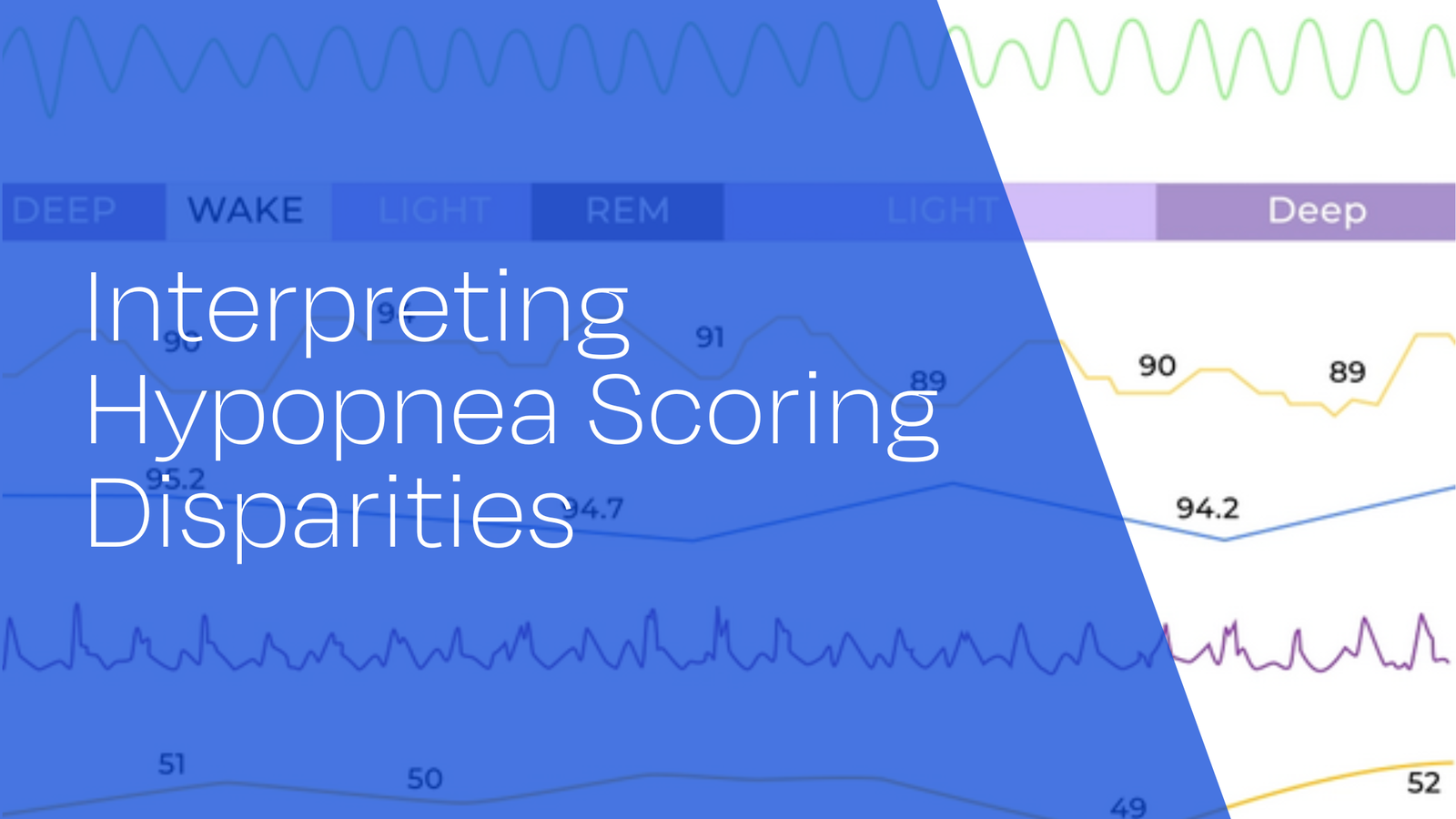 Interpreting Hypopnea Scoring Disparities: Methodological Considerations in Recent OSA Diagnostic Research